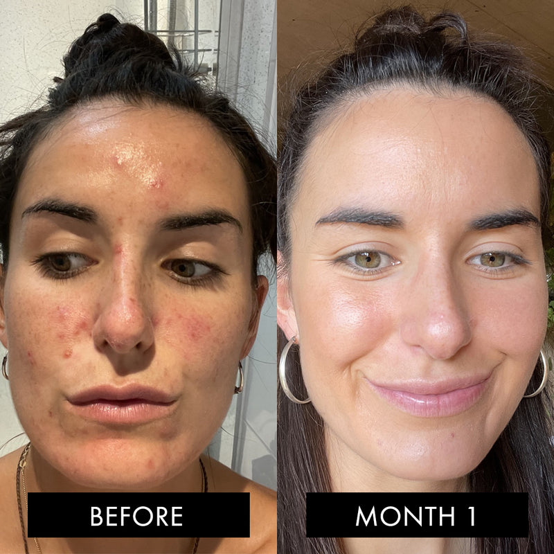 The Skin Elixir®