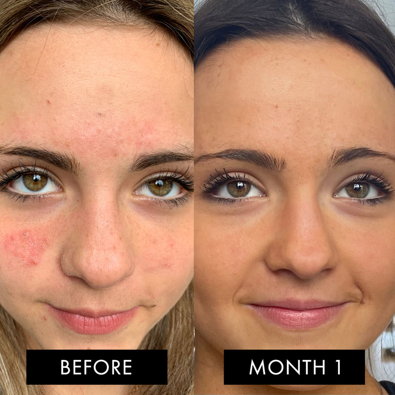 The Skin Elixir®